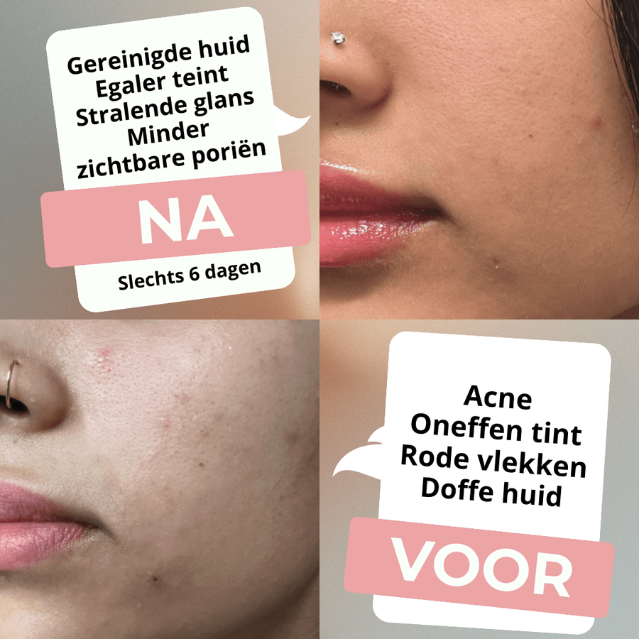 Anua | Komplett Skincare-rutin - Glow House