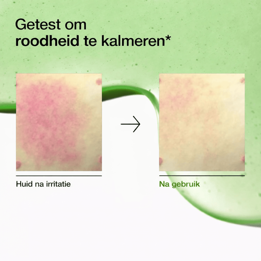 Anua | Azelaic Acid Serum - Glow House