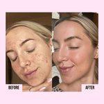 Medicube | PDRN Pink Collagen Capsule Cream - Glow House