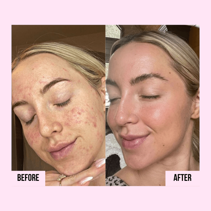 Medicube | PDRN Pink Collagen Capsule Cream - Glow House