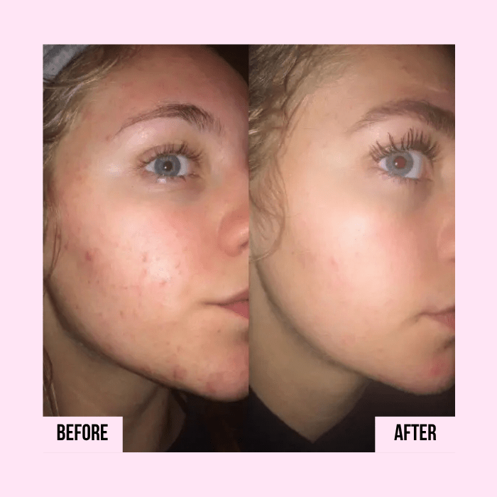 Medicube | PDRN Pink Collagen Capsule Cream - Glow House