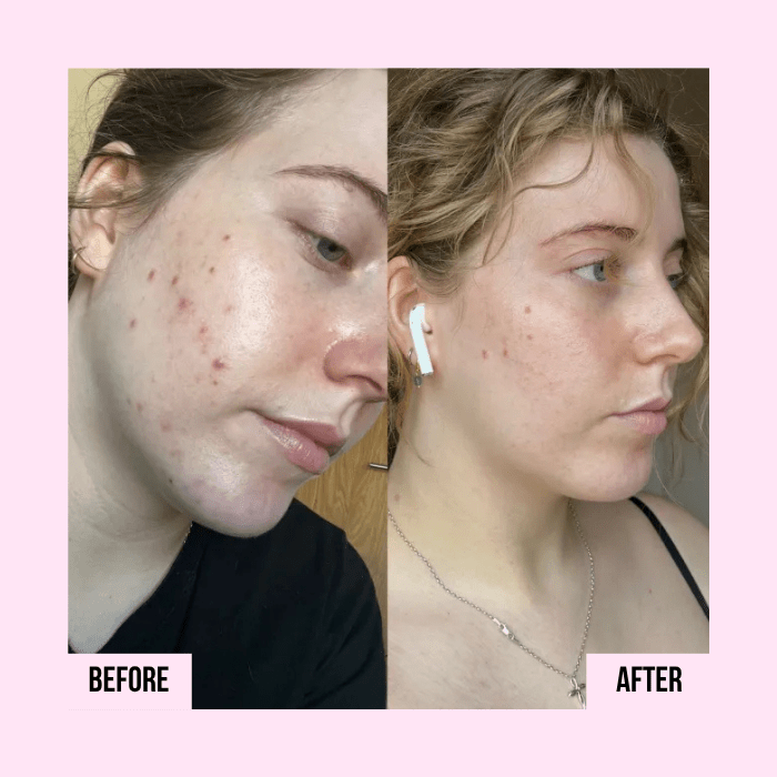 Medicube | PDRN Pink Collagen Capsule Cream - Glow House