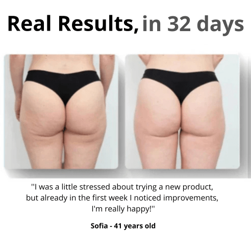 K-BEAUTY Cellulite Massager - Glow House