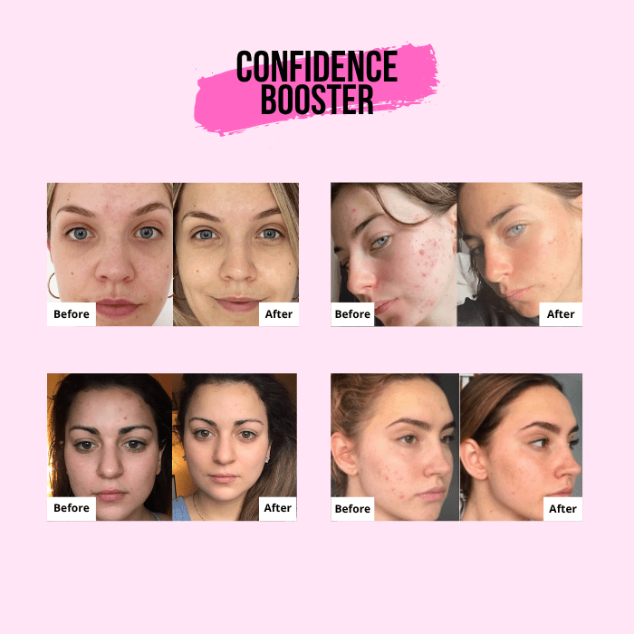 Medicube | PDRN Pink Collagen Capsule Cream - Glow House